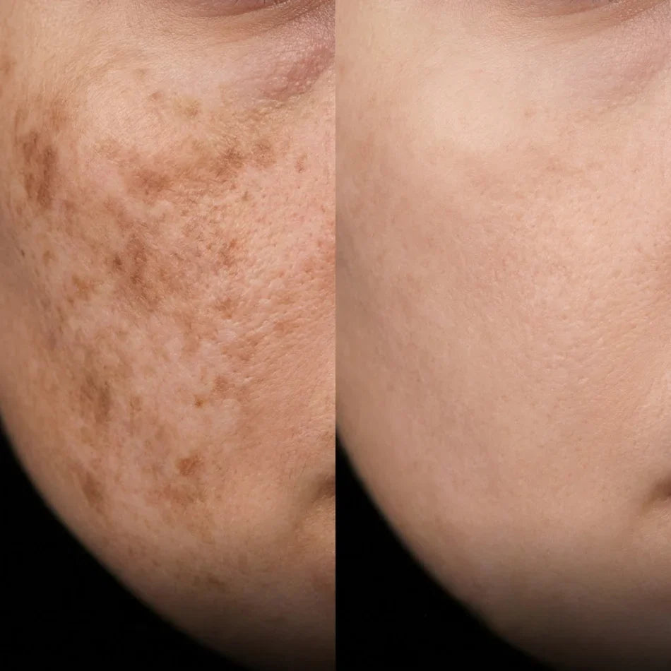 K·Skin Radiance Cream con 2 % de Niacinamida + Ácido Hialurónico