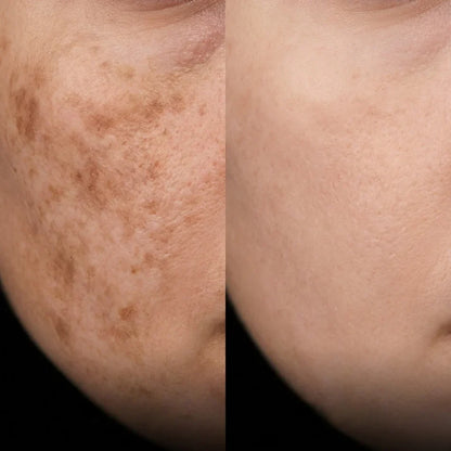 K·Skin Radiance Cream con 2 % de Niacinamida + Ácido Hialurónico