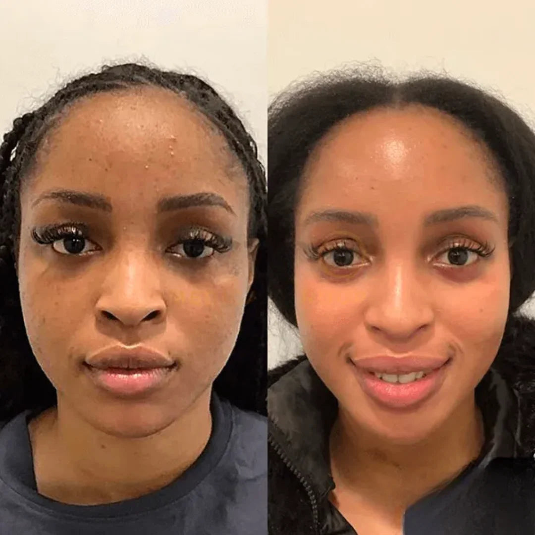 K·Skin Radiance Cream con 2 % de Niacinamida + Ácido Hialurónico