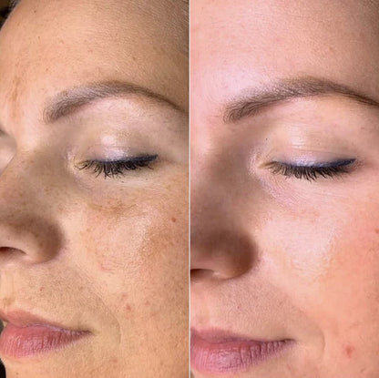 K·Skin Radiance Cream con 2 % de Niacinamida + Ácido Hialurónico